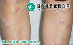 皮膚科診療項目