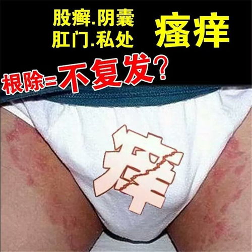 草本護肌新選擇 解析潤吉漫苗方清毒王濕清霜在皮膚護理中的應用